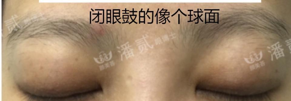 眼镜外鼓调节方法是什么？视频中如何正确调整？  第1张
